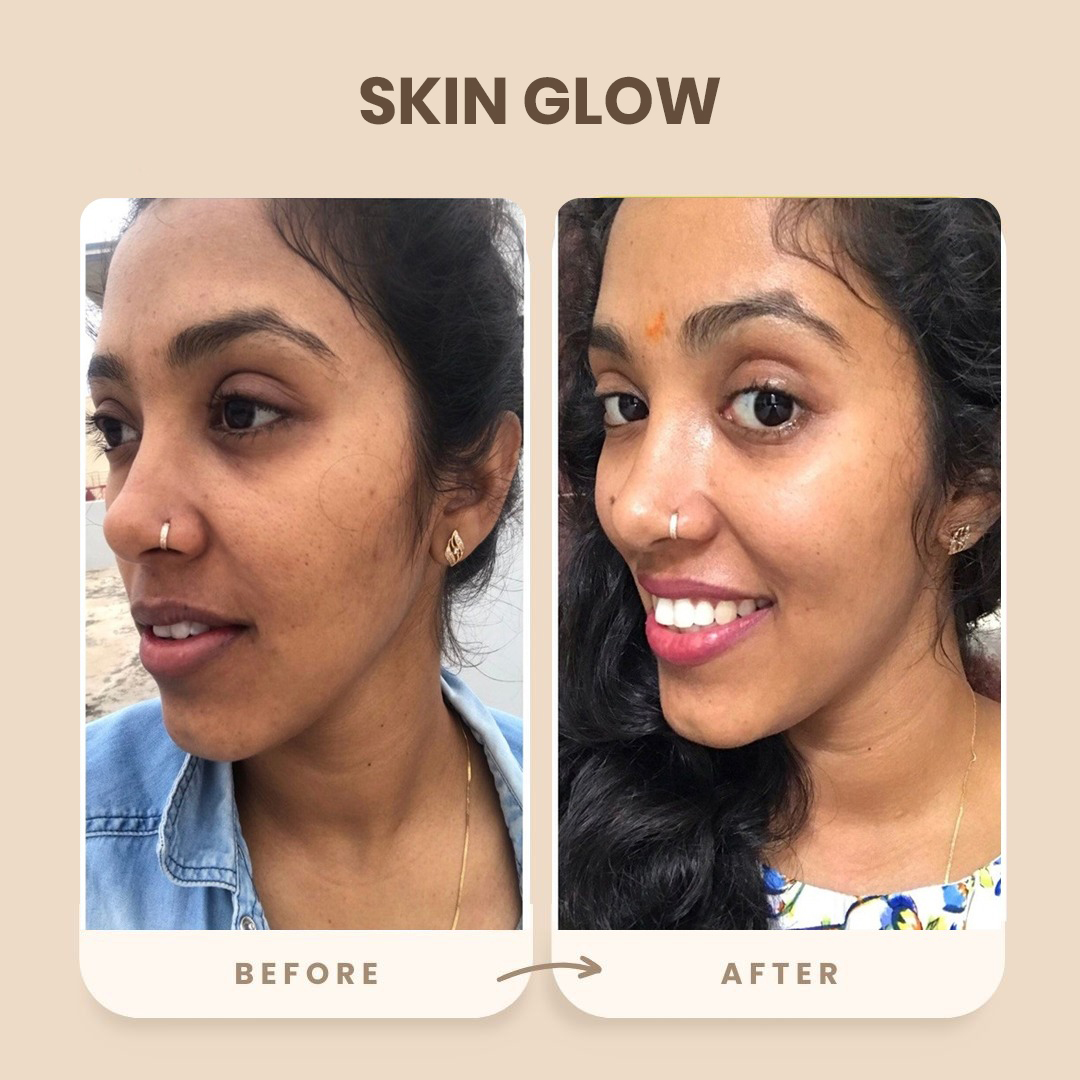 Skin Glow